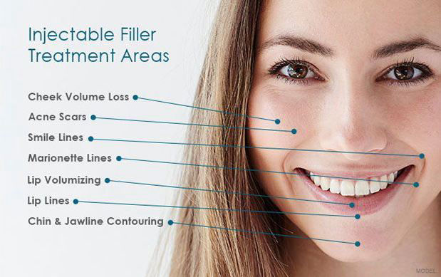 Dermal Fillers Glasgow