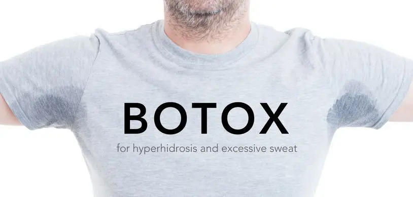 underarm sweating botox